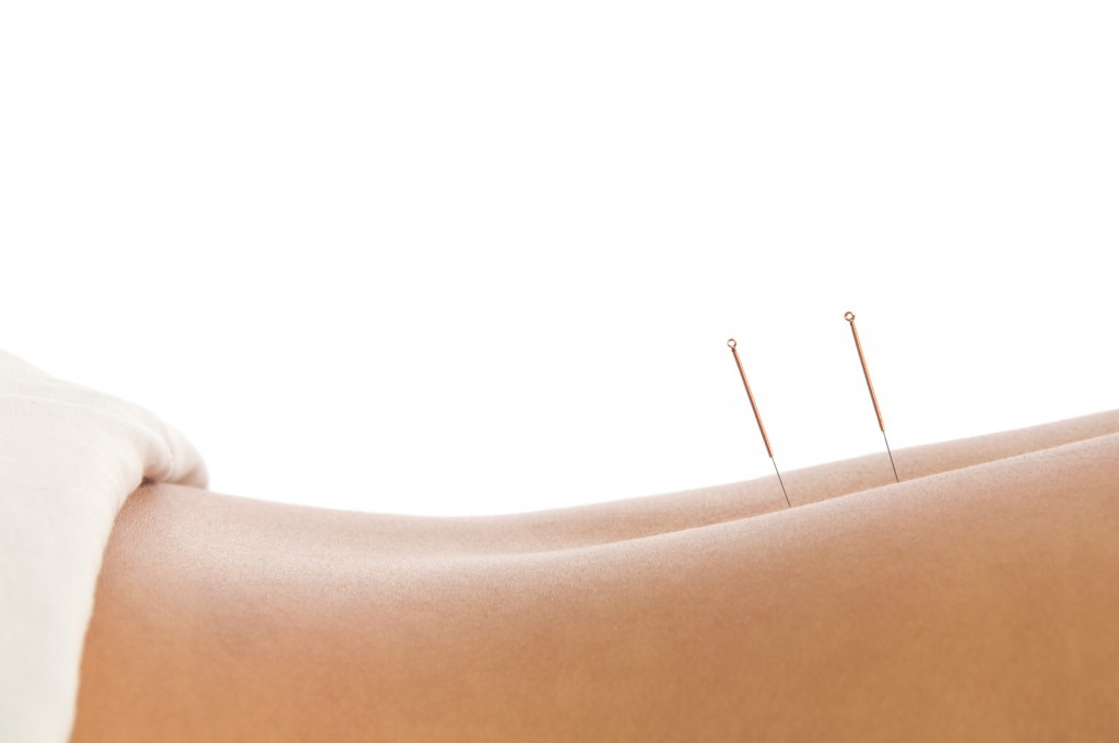 acupuncture needles orange acupuncture